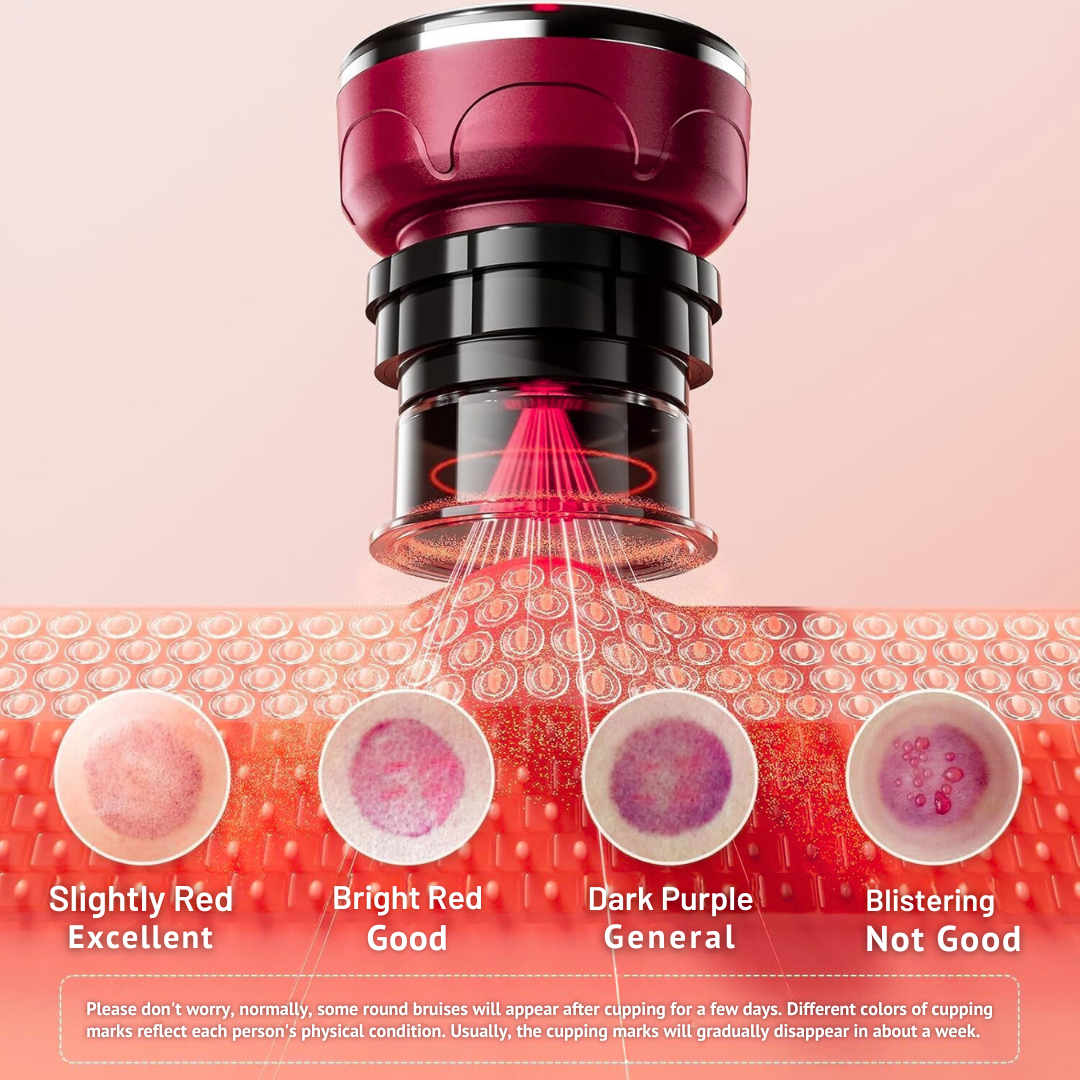Smart Cupping Massager with Heat – Deep Tissue Relaxation | Home Wellness Device