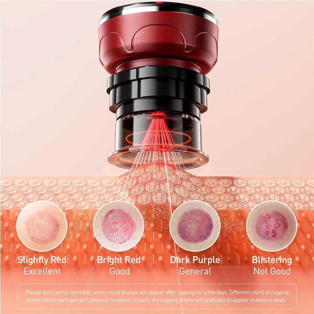 Smart Cupping Wellness Device with Heat A Relaxing At-Home Wellness Experience
