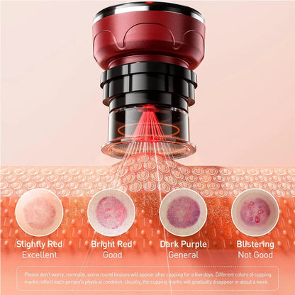 Smart Cupping Wellness Device with Heat A Relaxing At-Home Wellness Experience